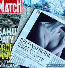 Reconstruire ses seins après le cancer - Paris Match