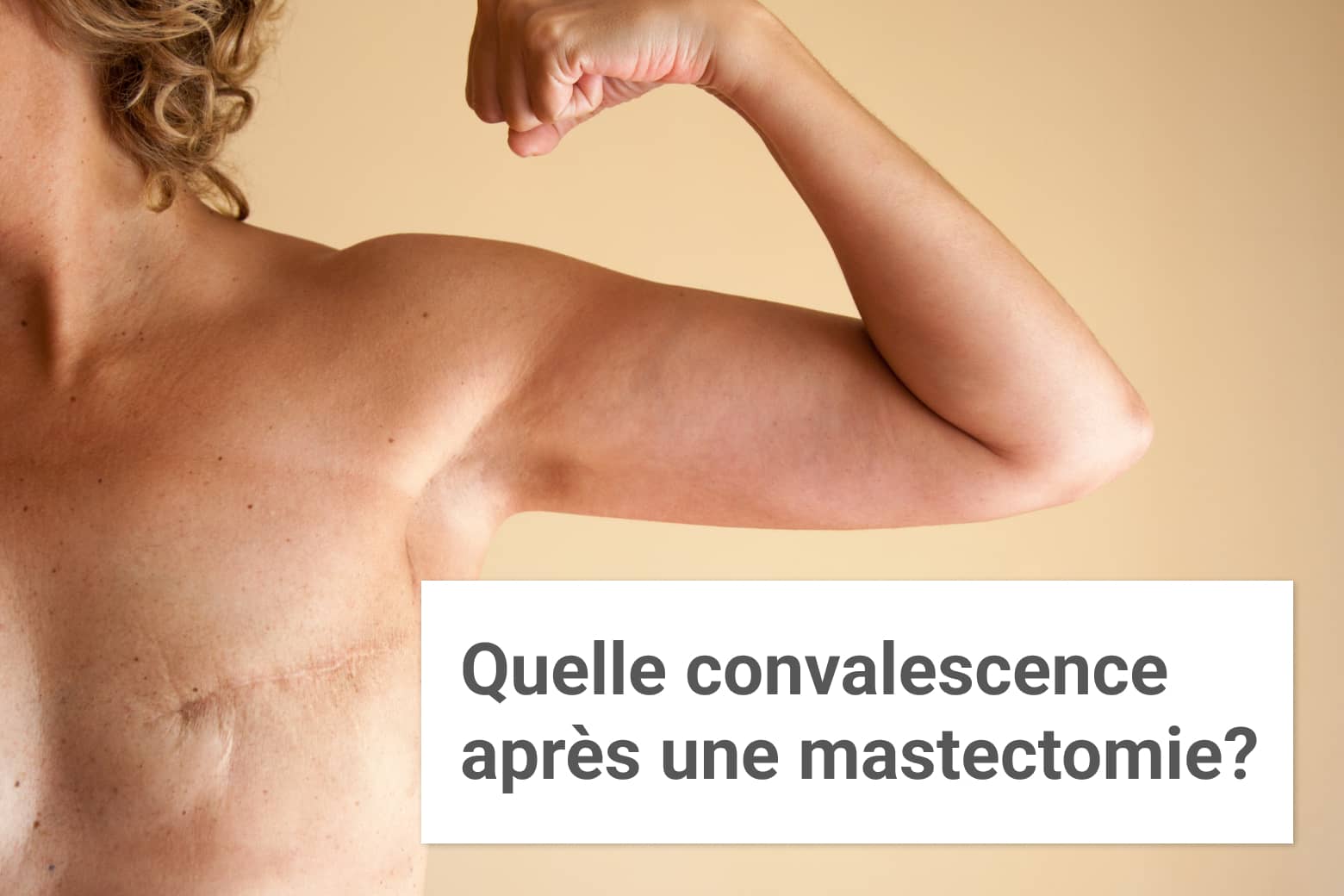 Quelle convalescence après une mastectomie ? | Paris| Institut du sein