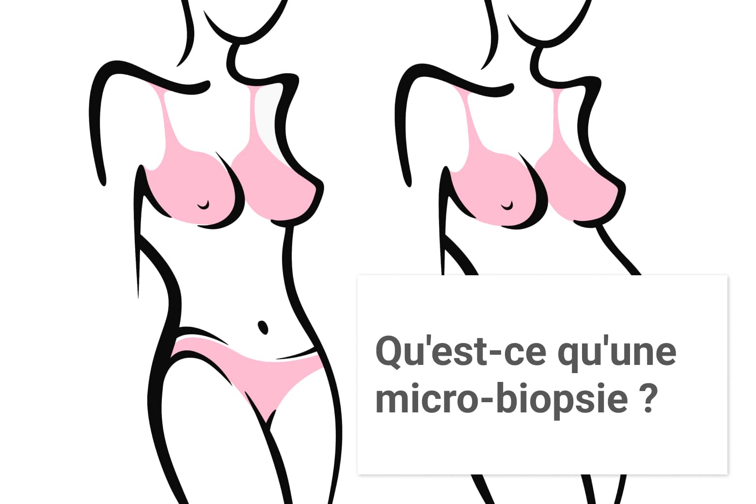 Qu'est-ce qu'une microbiopsie du sein ?, Institut du sein