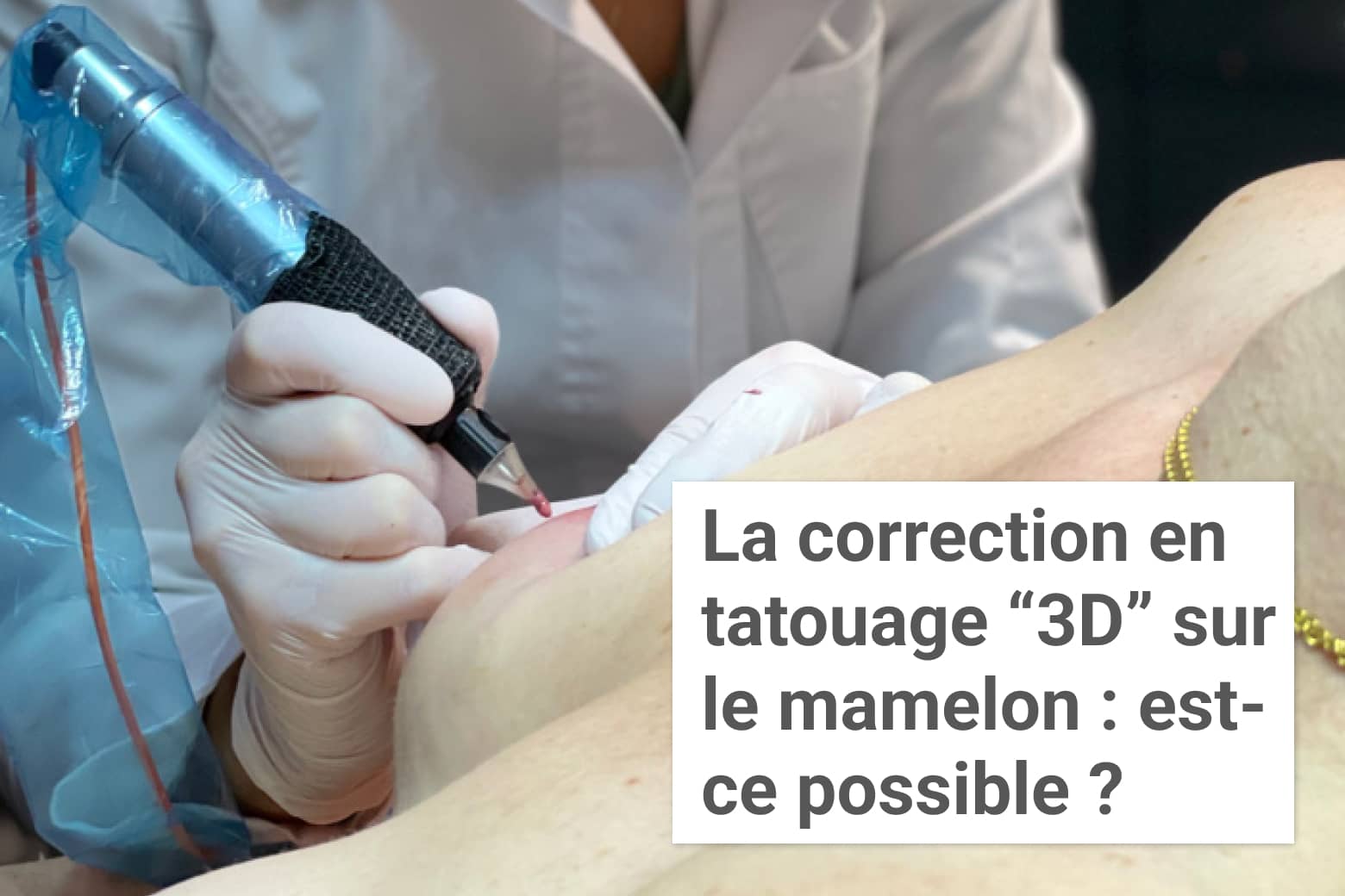 Reconstruction de l'aréole et du mamelon par tatouage : est-ce possible ? | Institut du Sein | Paris