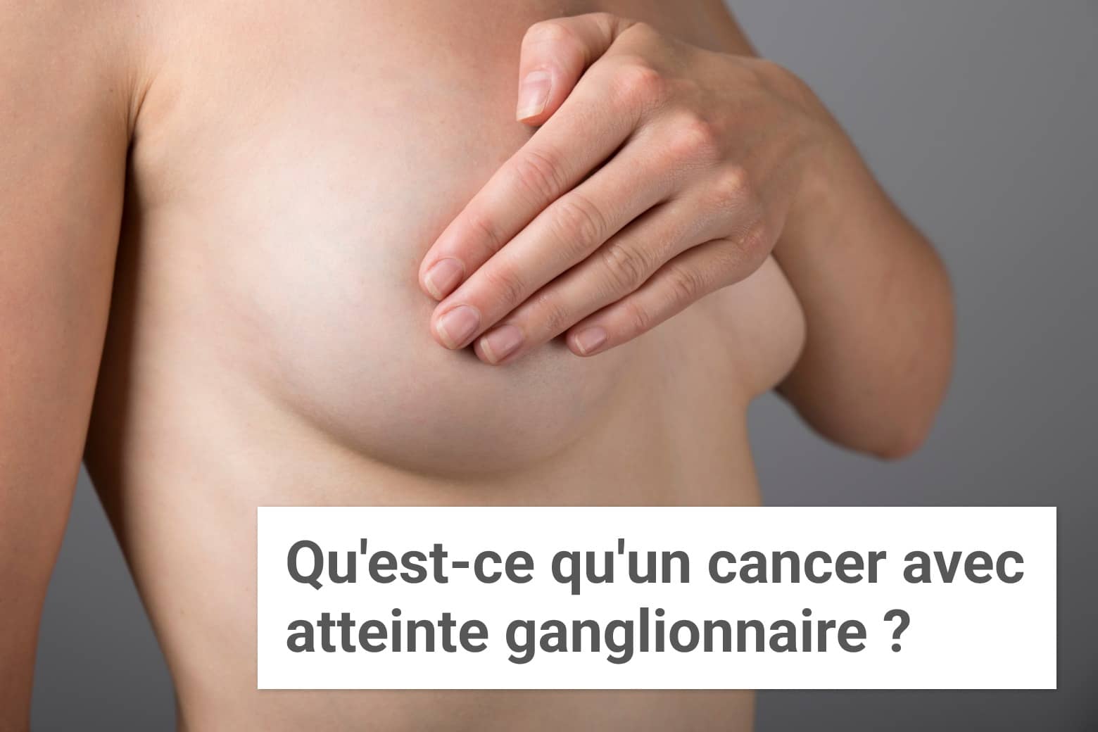 Qu'est-ce qu'un cancer du sein avec atteinte ganglionnaire ? | Institut du Sein | Paris