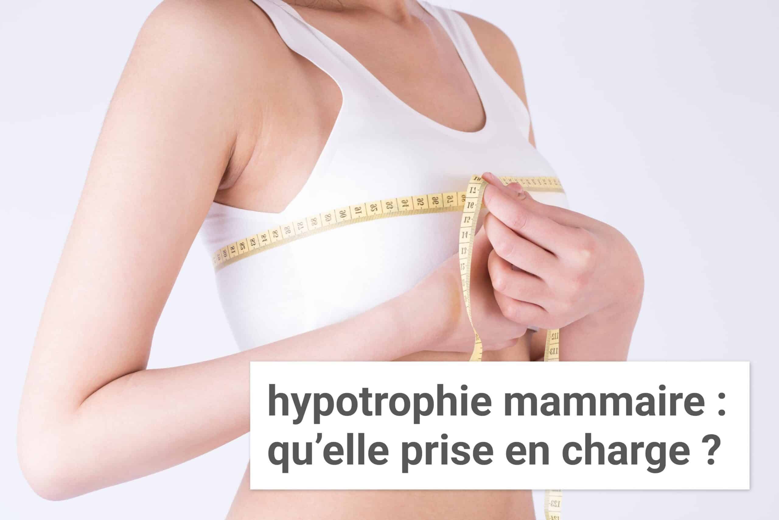 Hypotrophie mammaire : quelle prise en charge ? | Institut du Sein | Paris